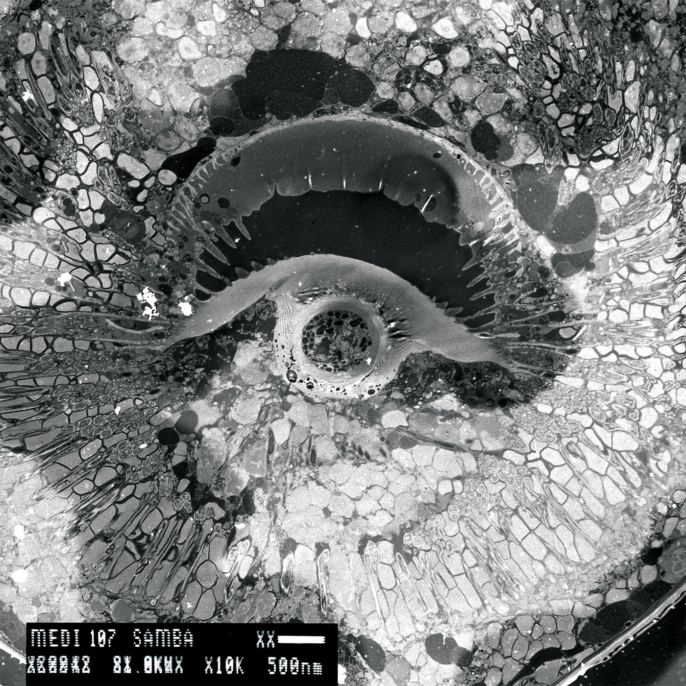 medi107